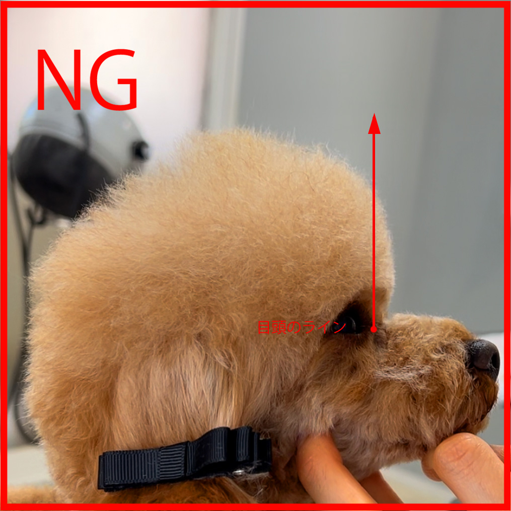 NG目頭